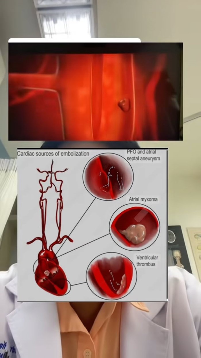 หญิง 50 ดื่มกาแฟแล้วใจสั่น หญิง 50 ดื่มกาแฟแล้วใจสั่น