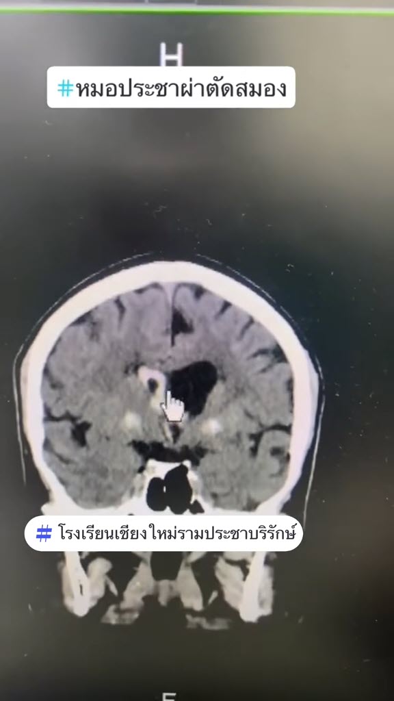 กินยากับเหล้า กินยากับเหล้า