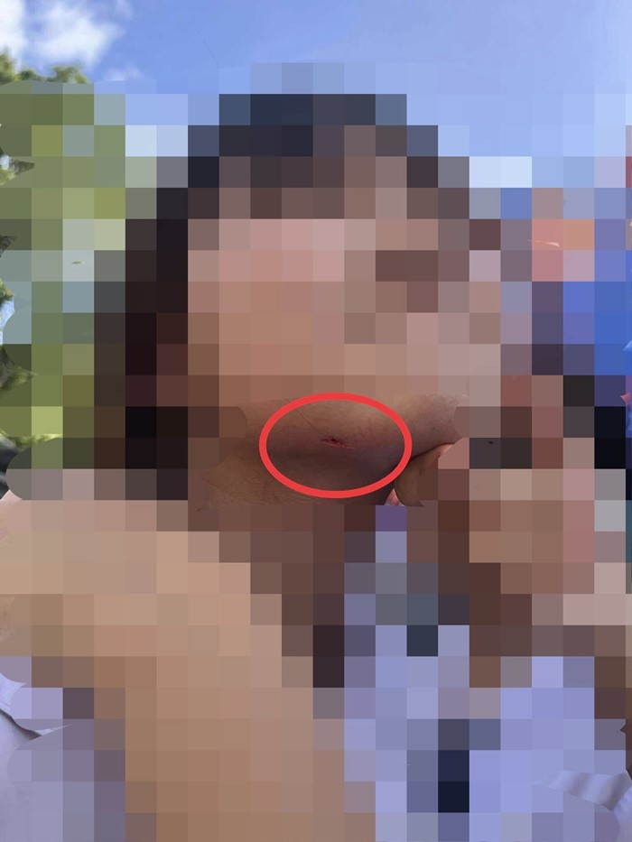 เด็ก 15 หลุดจากเครื่องเล่นซีเวฟ ถูกเหวี่ยงหวิดตกพื้น เด็ก 15 หลุดจากเครื่องเล่นซีเวฟ ถูกเหวี่ยงหวิดตกพื้น