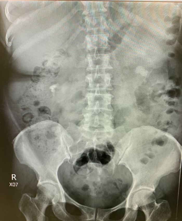 ทิดแย้ม ทิดแย้ม