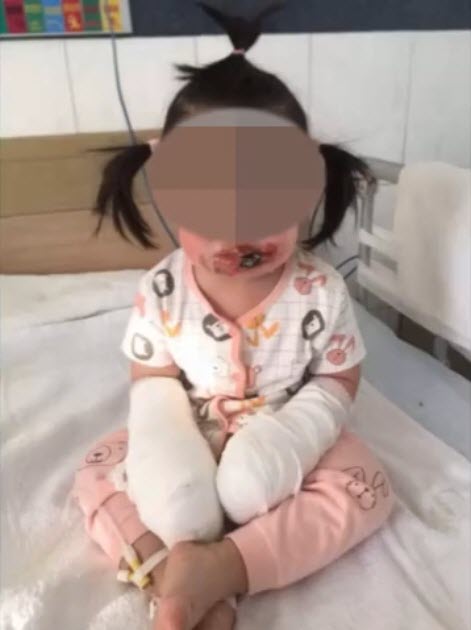 ตะปูจิ้มปลั๊กไฟ ตะปูจิ้มปลั๊กไฟ