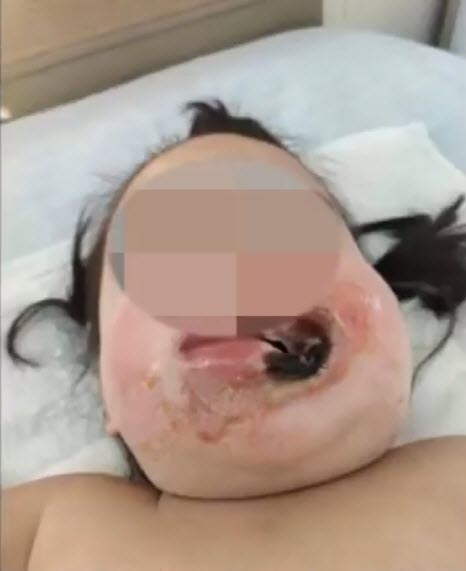 ตะปูจิ้มปลั๊กไฟ ตะปูจิ้มปลั๊กไฟ