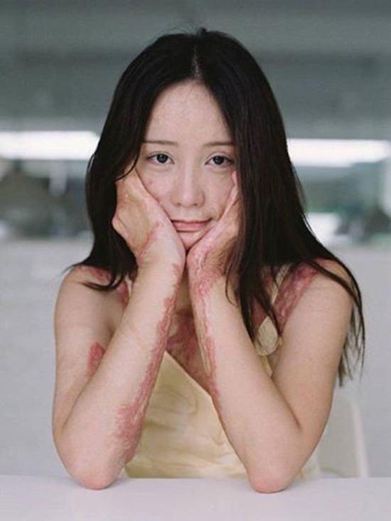 จุดไฟเผา ข่าวต่างประเทศ จุดไฟเผา ข่าวต่างประเทศ