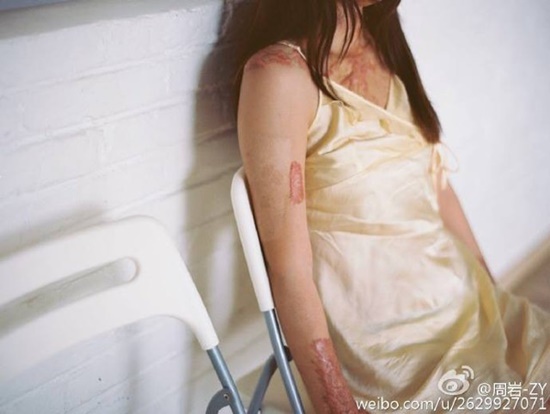 จุดไฟเผา ข่าวต่างประเทศ จุดไฟเผา ข่าวต่างประเทศ