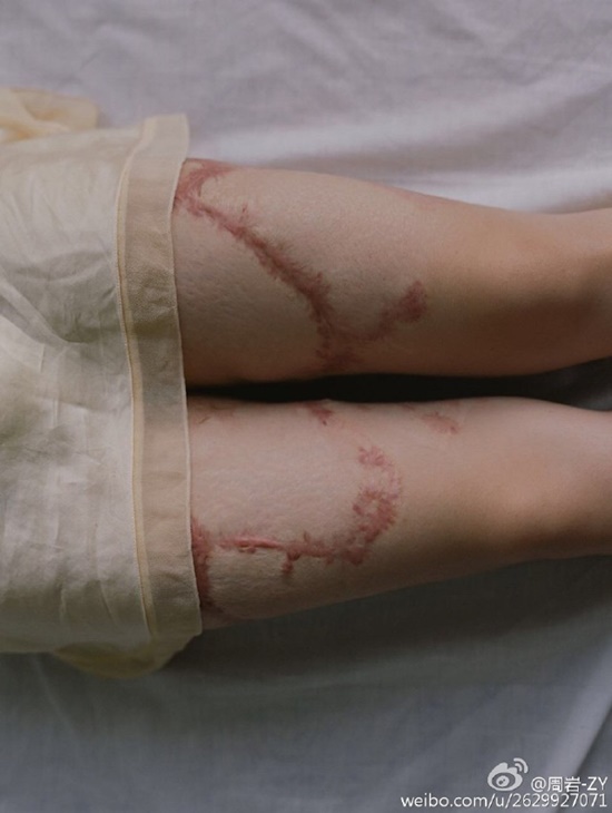 สาวเผยโฉมสุดบอบช้ำสะท้อนฝันร้าย ถูกหนุ่มที่มาหลงรักจุดไฟเผาทั้งเป็น สาวเผยโฉมสุดบอบช้ำสะท้อนฝันร้าย ถูกหนุ่มที่มาหลงรักจุดไฟเผาทั้งเป็น