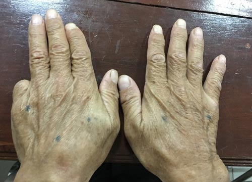 จับยากูซ่า จับยากูซ่า