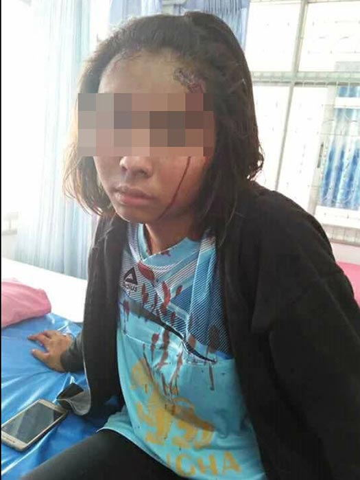 ทำร้ายผู้หญิง ทำร้ายผู้หญิง