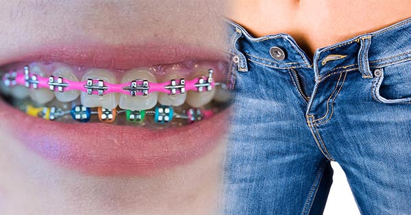 จัดฟันทำออรัลเซ็กส์ จัดฟันทำออรัลเซ็กส์