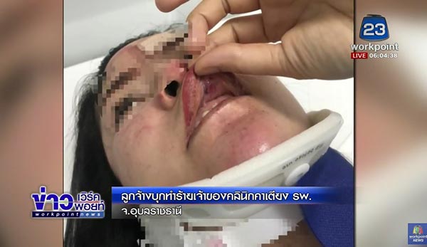 ทำร้ายนายจ้าง ทำร้ายนายจ้าง