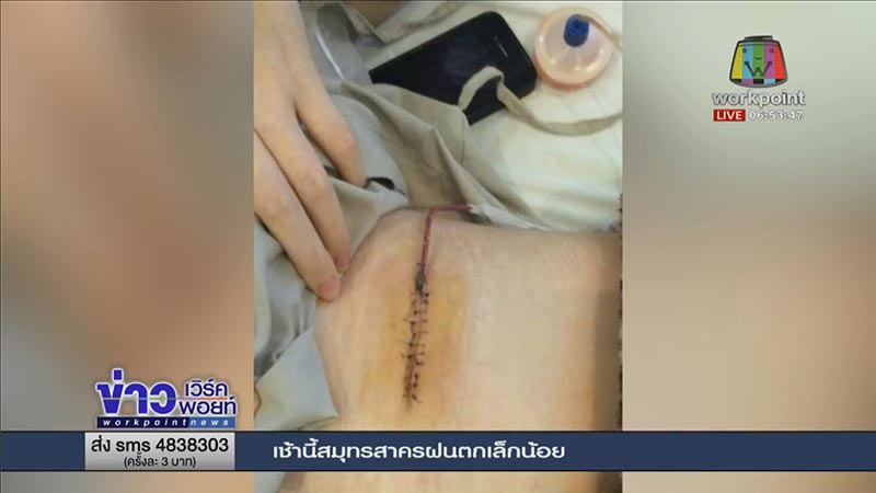 ศัลยกรรมเกาหลี ศัลยกรรมเกาหลี