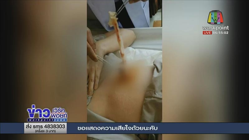 ศัลยกรรมเกาหลี ศัลยกรรมเกาหลี