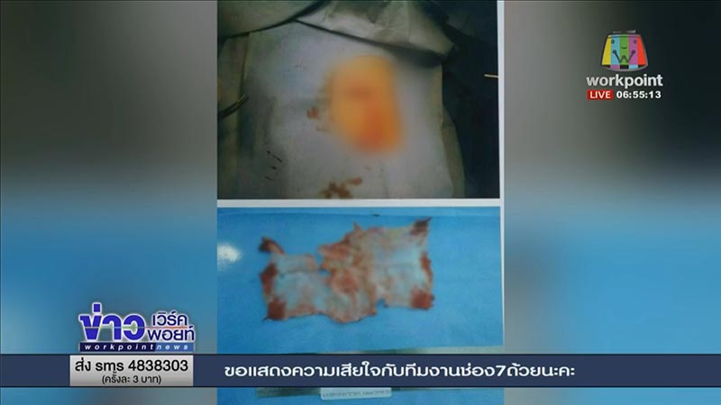 ศัลยกรรมเกาหลี ศัลยกรรมเกาหลี