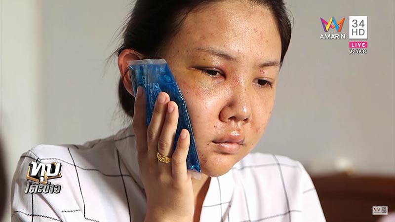 ทอมทำร้ายแฟน ทอมทำร้ายแฟน