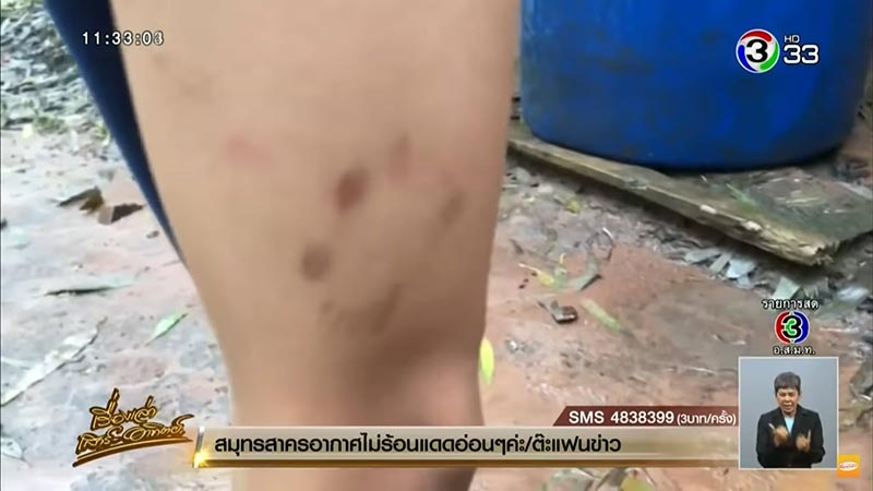 กินเครื่องในหมา กินเครื่องในหมา