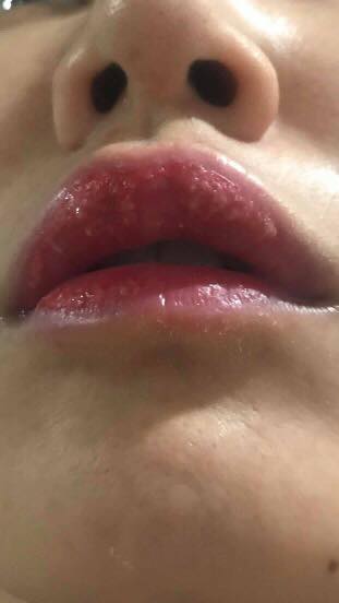 สักปากชมพู สักปากชมพู