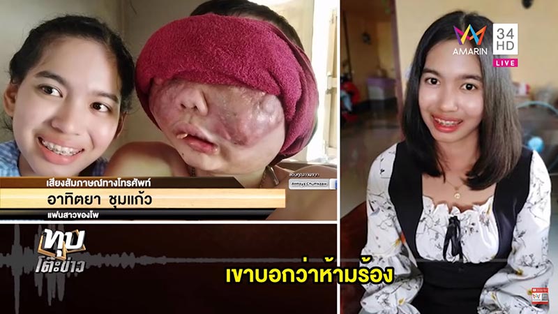 แฟนป่วยมะเร็ง แฟนป่วยมะเร็ง