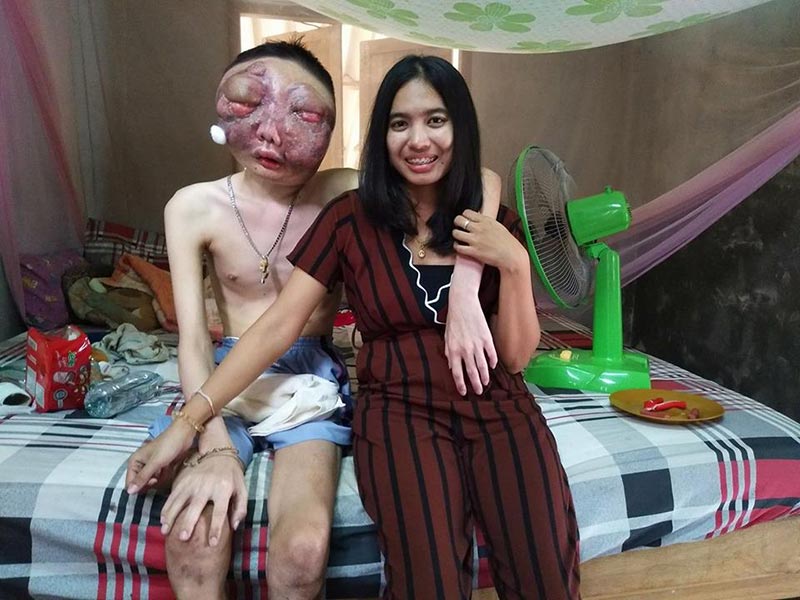 แฟนป่วยมะเร็ง แฟนป่วยมะเร็ง