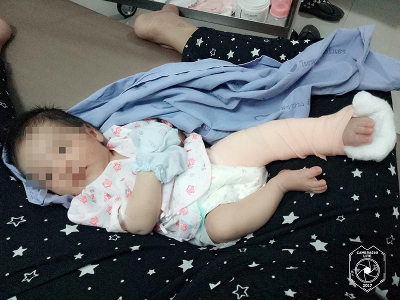 ดัดขา ดัดขา