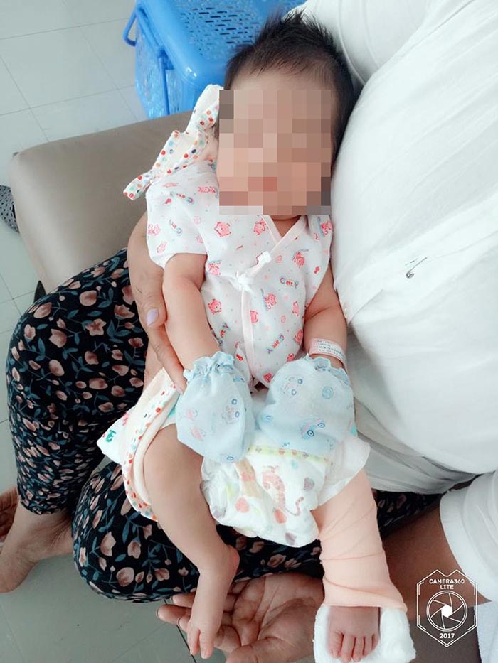 ดัดขา ดัดขา