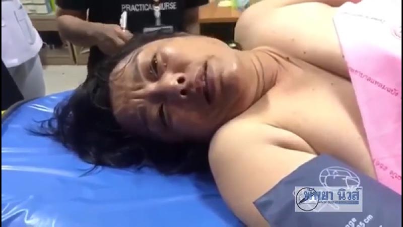 โซดาไฟปะทุ โซดาไฟปะทุ