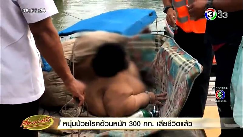 โรคอ้วน โรคอ้วน