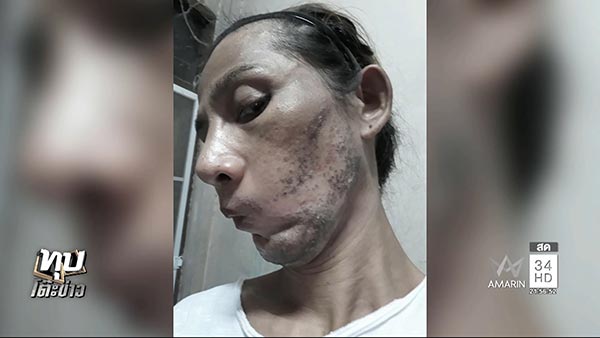 โวยคลินิกความงาม โวยคลินิกความงาม