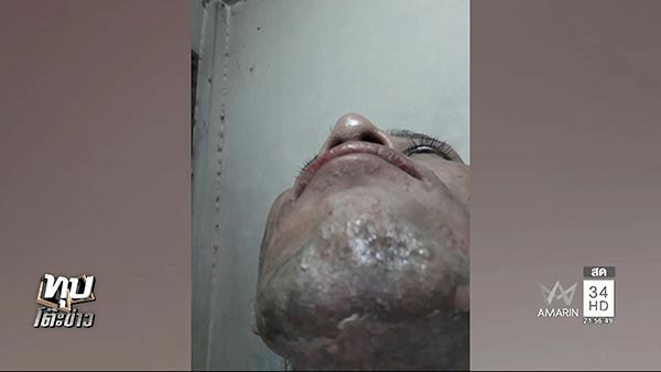 โวยคลินิกความงาม โวยคลินิกความงาม