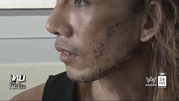 โวยคลินิกความงาม โวยคลินิกความงาม