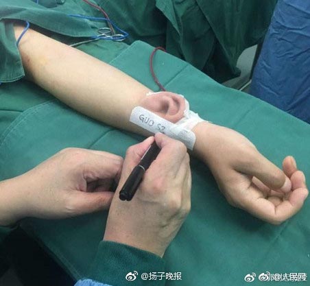 ปลูกถ่ายอวัยวะ ปลูกถ่ายอวัยวะ