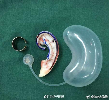 ปลูกถ่ายอวัยวะ ปลูกถ่ายอวัยวะ