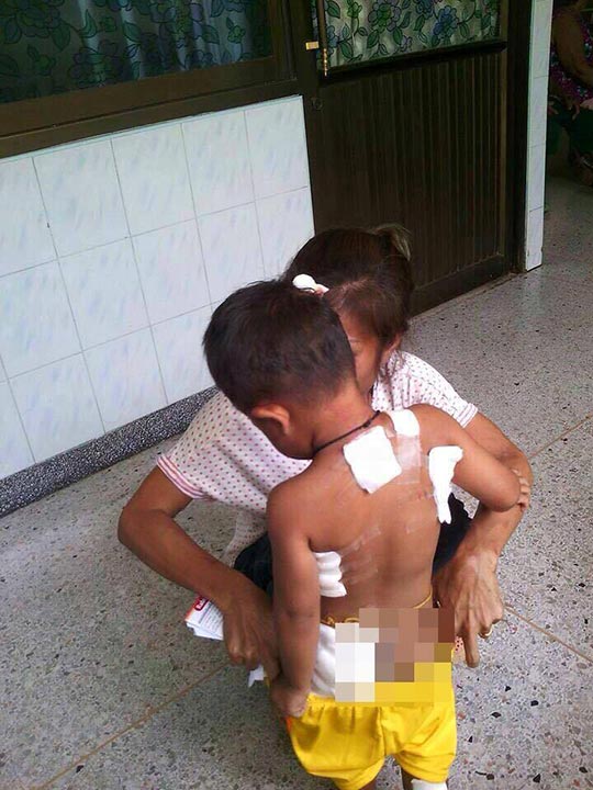 หมารุมกัดเด็ก หมารุมกัดเด็ก