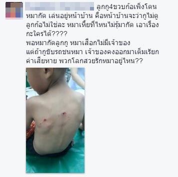 หมารุมกัดเด็ก หมารุมกัดเด็ก