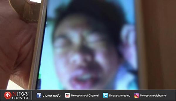 แพ้อาหารเสริม แพ้อาหารเสริม