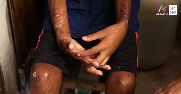 เด็ก 11 ขวบ เด็ก 11 ขวบ