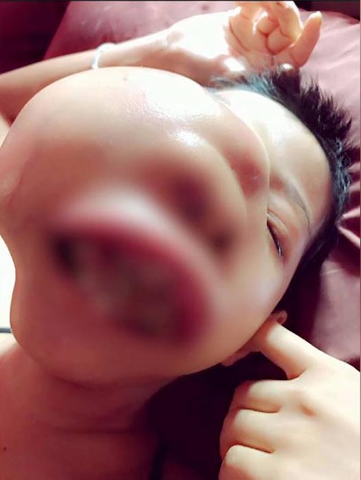 เจนี่ สาวป่วยมะเร็ง เจนี่ สาวป่วยมะเร็ง