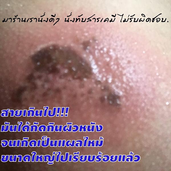 นั่งทับสารเคมี นั่งทับสารเคมี