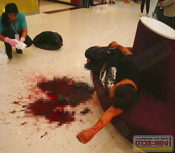 อ้วกเป็นเลือด อ้วกเป็นเลือด