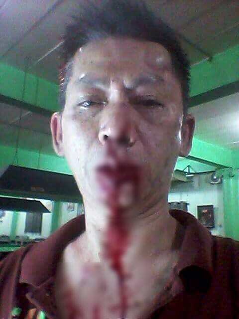 ทหารรุมทำร้าย ทหารรุมทำร้าย