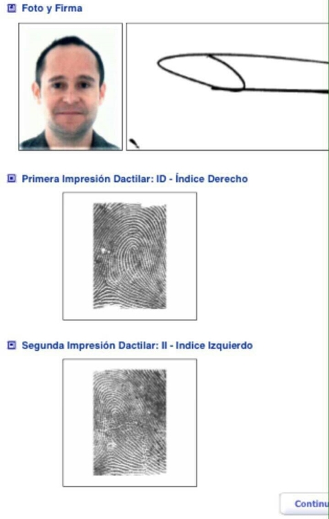 ชิ้นส่วนมนุษย์ ชิ้นส่วนมนุษย์