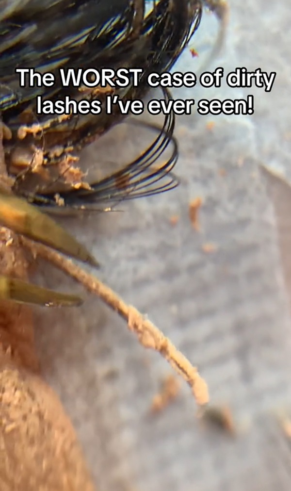 ขนตาสกปรก ขนตาสกปรก