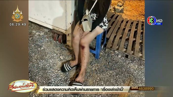 ทำร้ายร่างกายผู้หญิง ทำร้ายร่างกายผู้หญิง