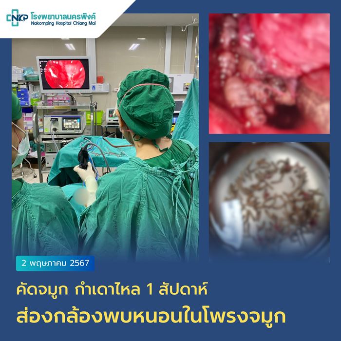 หนอนในโพรงจมูก หนอนในโพรงจมูก