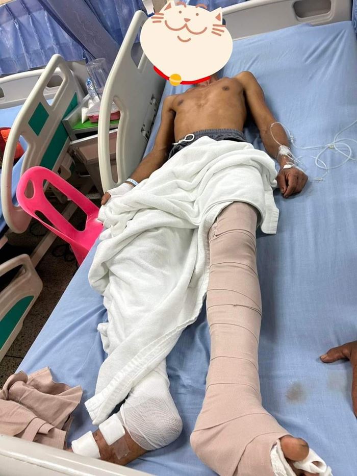 มีดกรีดเอาเกลือทา มีดกรีดเอาเกลือทา