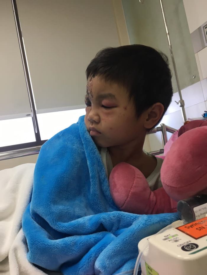 รู้จักกับ น้องเอวา เด็กป่วยมะเร็งระยะสุดท้าย รู้จักกับ น้องเอวา เด็กป่วยมะเร็งระยะสุดท้าย