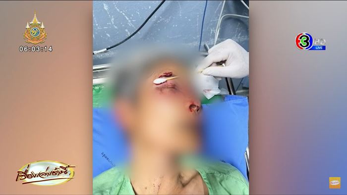 ฝรั่งต่อยผู้หญิง ฝรั่งต่อยผู้หญิง