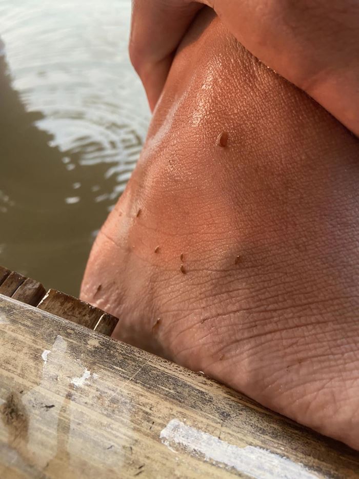 ปลิงเข็ม ปลิงเข็ม