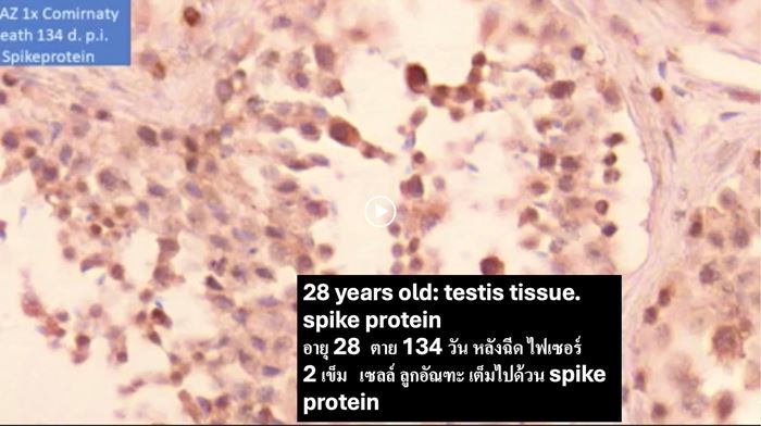 วัคซีนโควิด วัคซีนโควิด