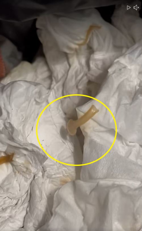 ปล้องสุกของพยาธิตัวตืด ปล้องสุกของพยาธิตัวตืด