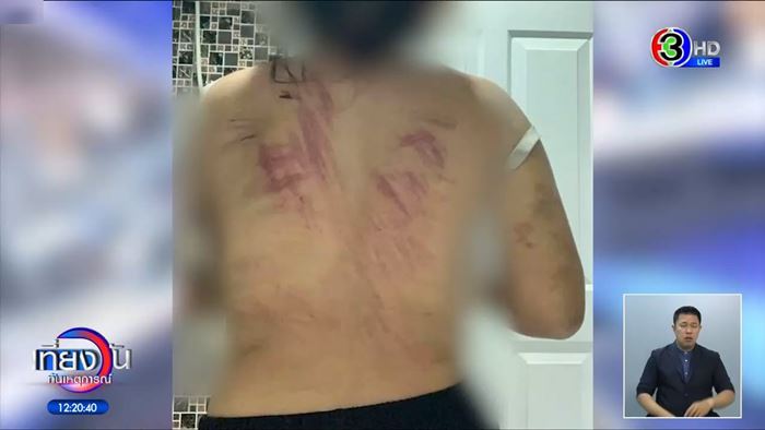 ลูกจ้างร้องถูกทำร้าย เจ้านายแจงสั่งสอน ย้ำเลี้ยงเหมือนคนในครอบครัว ลูกจ้างร้องถูกทำร้าย เจ้านายแจงสั่งสอน ย้ำเลี้ยงเหมือนคนในครอบครัว