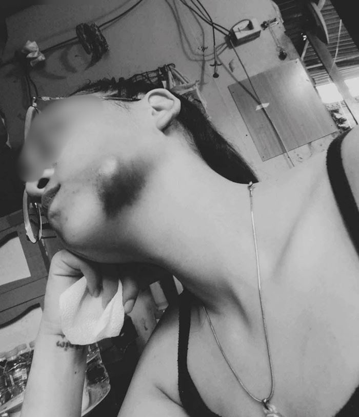 แฟนเก่าโหด บุกทำร้ายหญิงถึงบ้าน แฟนเก่าโหด บุกทำร้ายหญิงถึงบ้าน